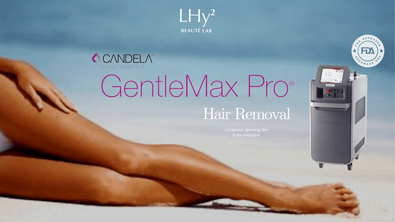 CANDELA GentleMax Pro 激光脫毛